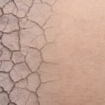 Oasis-for-Dry-Skin