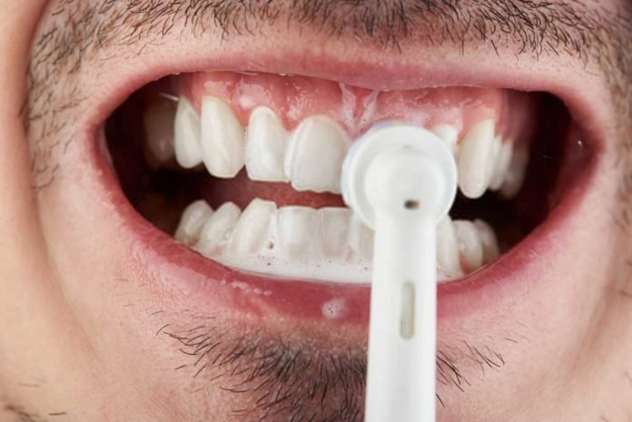 Whitening Your Teeth